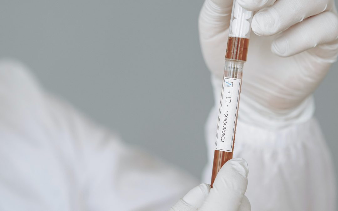 Test de Coronavirus – ¿Cuál me conviene más?
